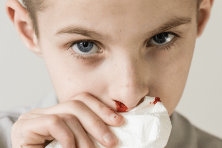 Stop the Bleed: 7 Essential Tips for Preventing and Treating&nbsp;Nosebleeds