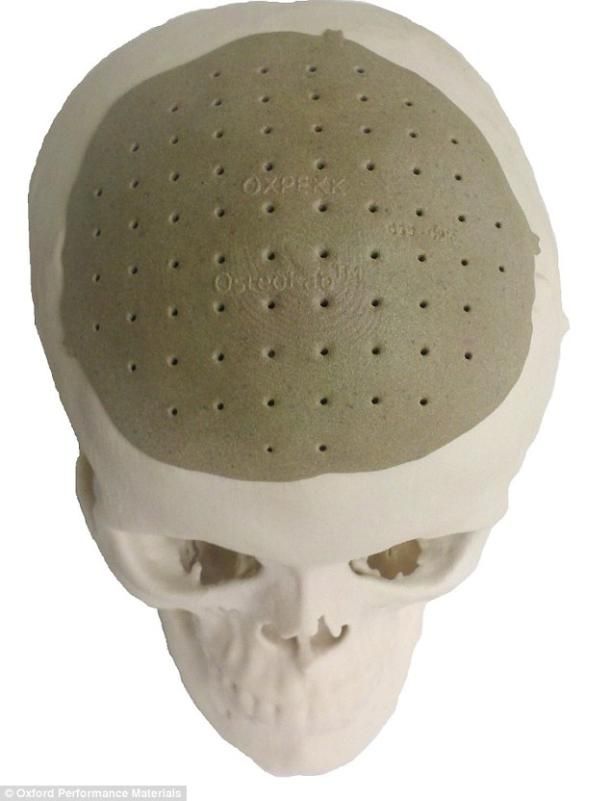 Utilizing 3D Printing in ENT&nbsp;Surgery