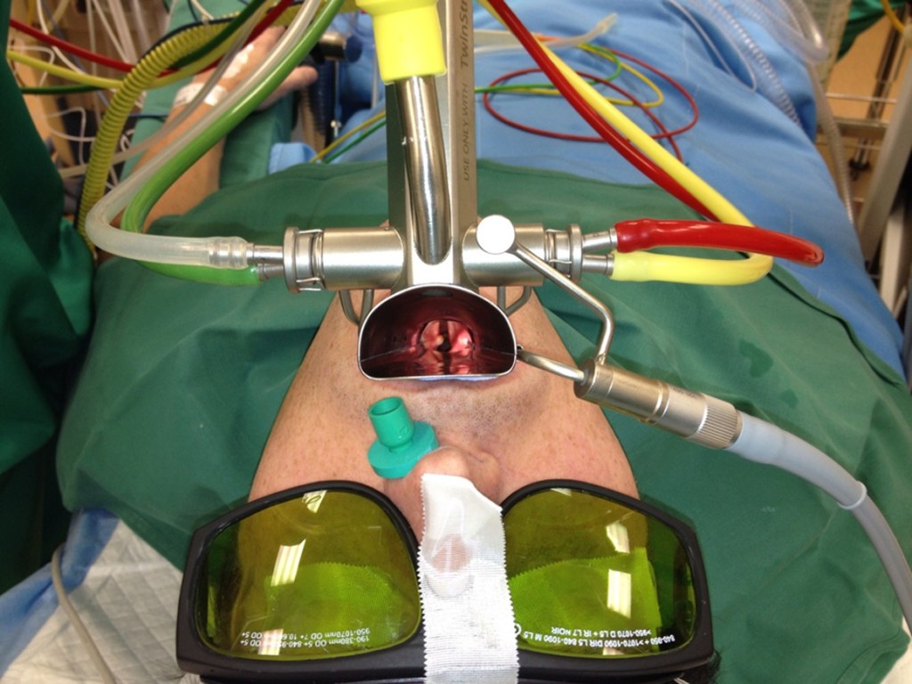 Comparison of Hemodynamics in Jet Ventilation vs. Intermittent Apnea for Airway Stenosis&nbsp;Surgery