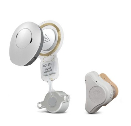 Bone Anchored Hearing&nbsp;Aid