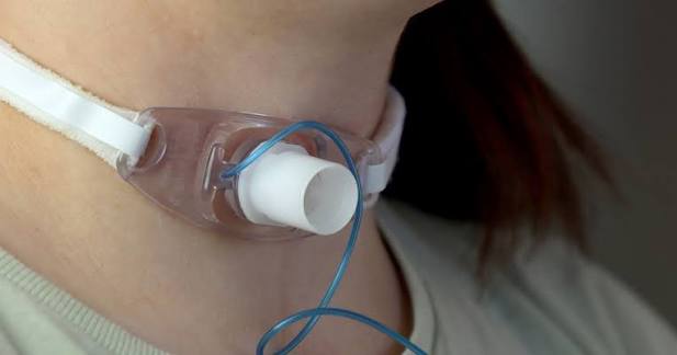 🌬️ Breathing Easier: Your Simple Guide to Tracheostomy Care at&nbsp;Home
