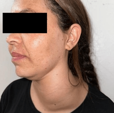 Side profile of a woman with long, braided hair, displaying facial features and skin texture.