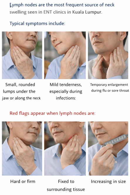 An informative graphic illustrating symptoms and concerns related to swollen lymph nodes in the neck, featuring a series of images showing a man palpating his neck.