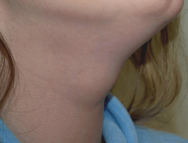 Close-up of a neck with soft skin texture and visible hair strands.