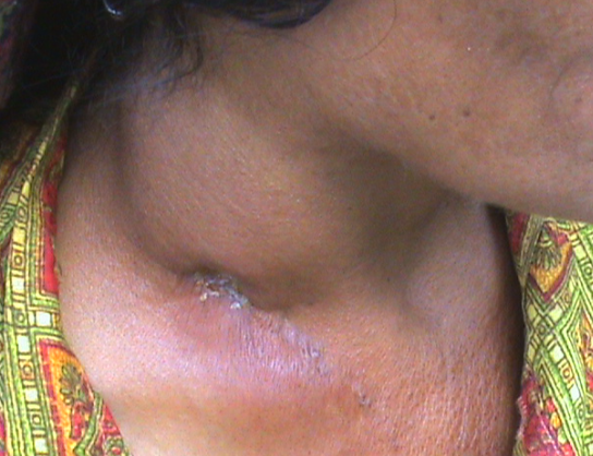 Close-up of the neck area showing a scar and skin texture.