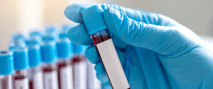 A gloved hand holds a test tube filled with blood, with several similar tubes in the background.