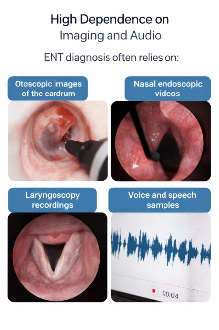 Otoscopy image showing the eardrum inside an ear